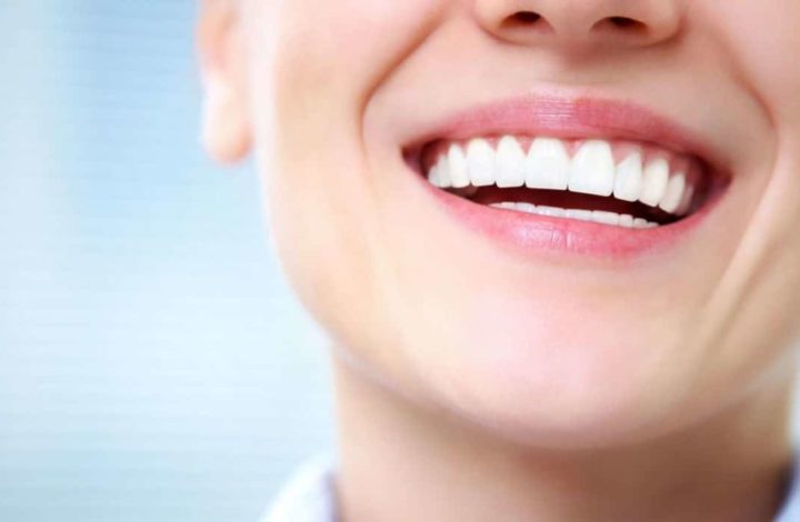 Chirurgie dentaire : Comment faire pour prendre soin de ses dents sans trop dépenser !