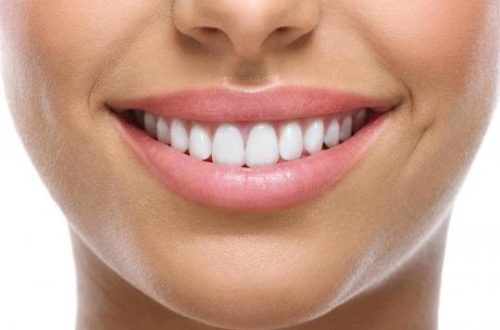 Chirurgie dentaire : Comment faire pour prendre soin de ses dents sans trop dépenser !
