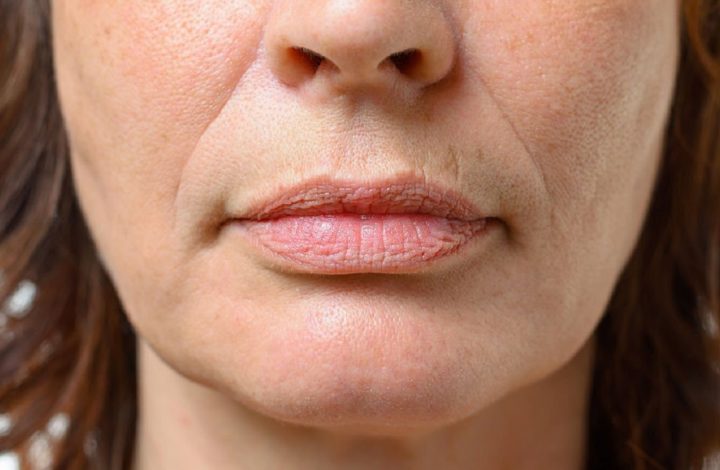 Anti-ride : Voici comment se débarrasser naturellement des rides autour de la bouche !