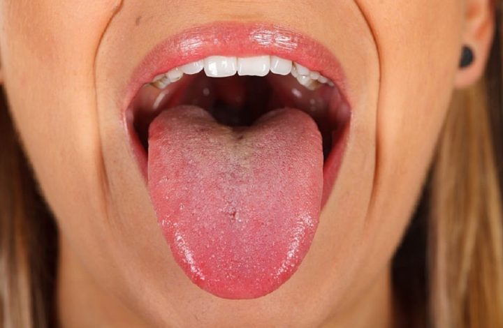 Santé : Découvrez ce que révèle la couleur de votre langue