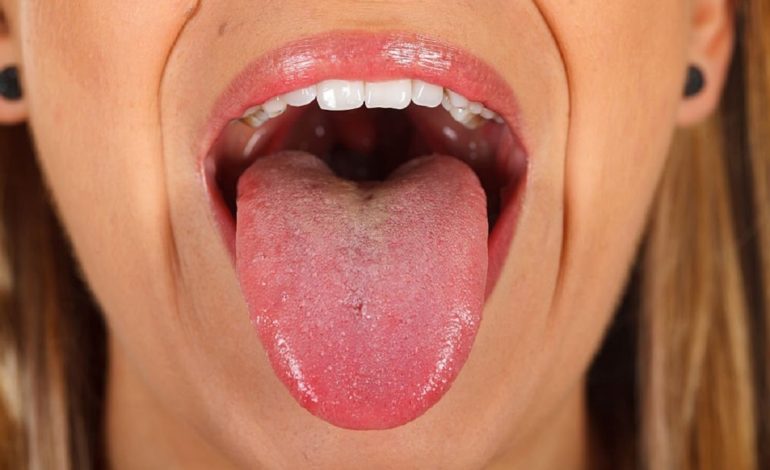 Santé : Découvrez sans attendre ce que révèle la couleur de votre langue sur votre état de santé !