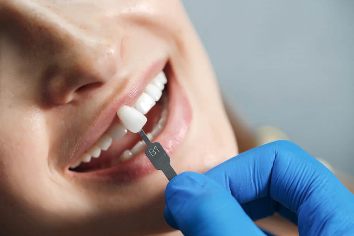 Implants dentaires