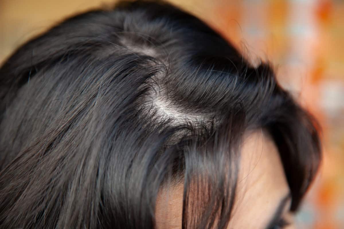 Cheveux gras