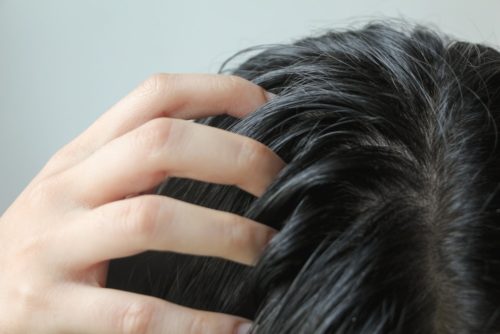Lutter contre les cheveux gras