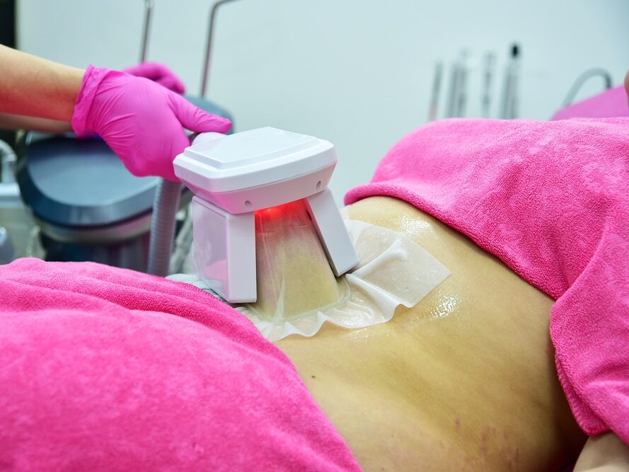 Femme qui fait de la Cryolipolyse